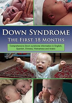 【中古】Down Syndrome: The First 18 Months [DVD]