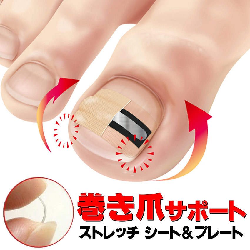 レジスタントプレートシステム 巻き爪 プレート レジスタントプレート