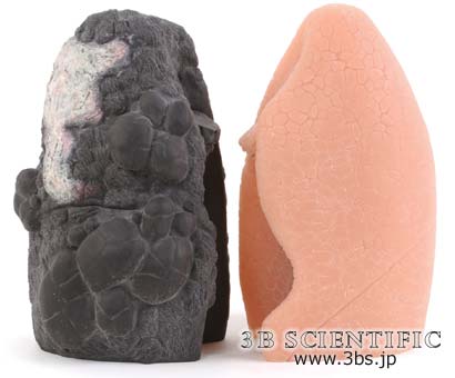 【貨物輸送無料】【無料思わしい話しあい 客体生産物】禁煙仕立て上げる用肺書き割りひな形