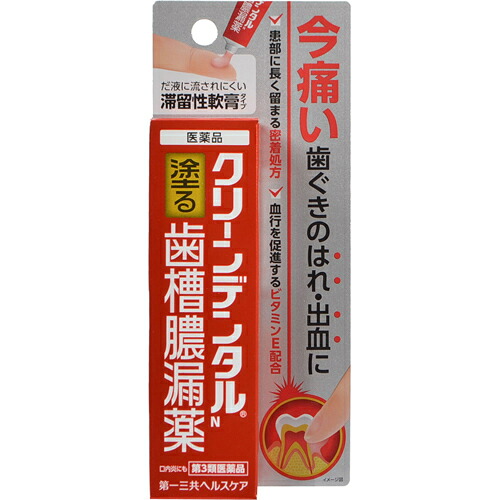 【第3類医薬品】【５個セット】 クリーンデンタルN 歯槽膿漏薬 16g×５個セット 【正規品】