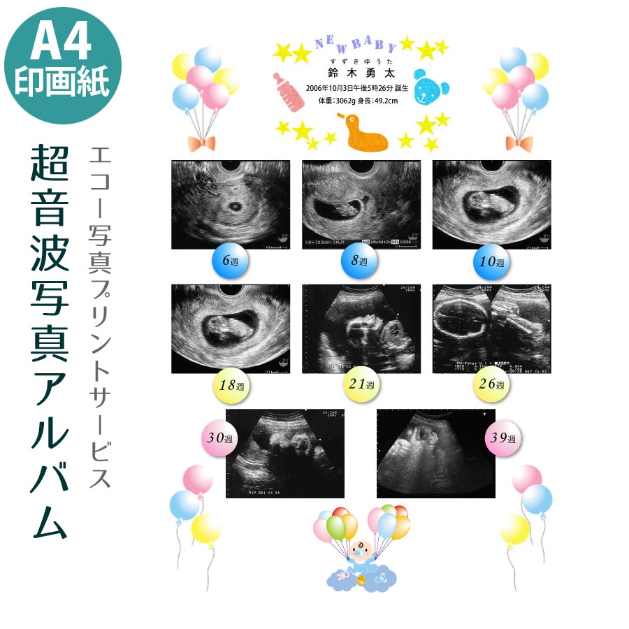 送料無料 超音波写真アルバム 男の子 赤ちゃんのエコー写真プリントサービス ナチュラル