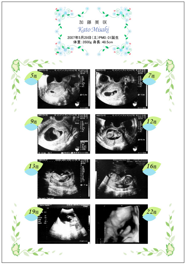 送料無料 超音波写真アルバム 男の子 赤ちゃんのエコー写真プリントサービス ナチュラル