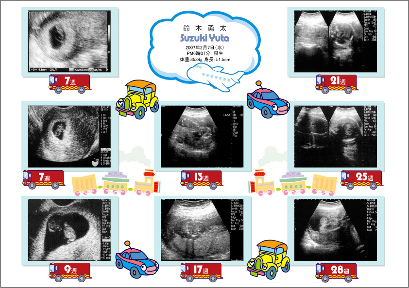 高品質新品 おなかの中の写真 思い出をきれいに保存 保管 Salacristal Pl