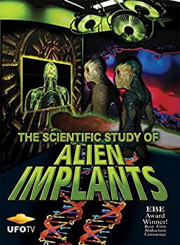 【中古】【輸入品・未使用】Scientific Study of Alien Implants [DVD] [Import]｜スカイマーケットプラス