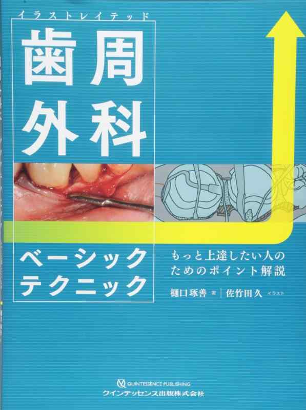 【中古】イラストレイテッド 歯周外科学第一義的方法