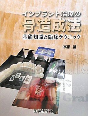 【中古】インプラント治療の骨造成法: 基礎知識と臨床テクニック