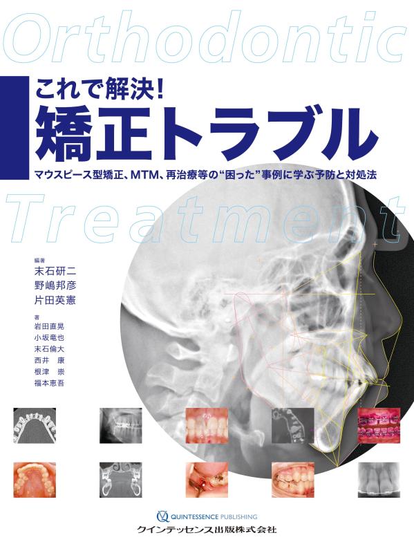 【中古】これで解決 矯正トラブル