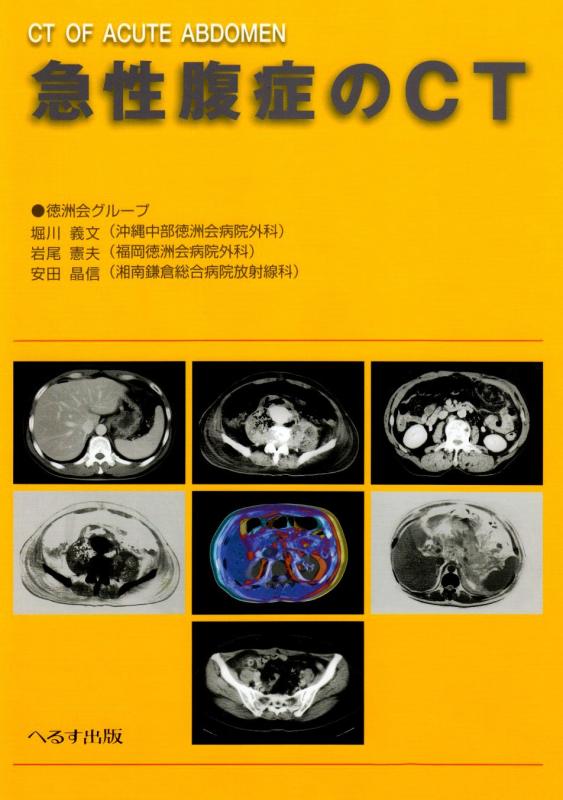 【中古】急性腹症のCT