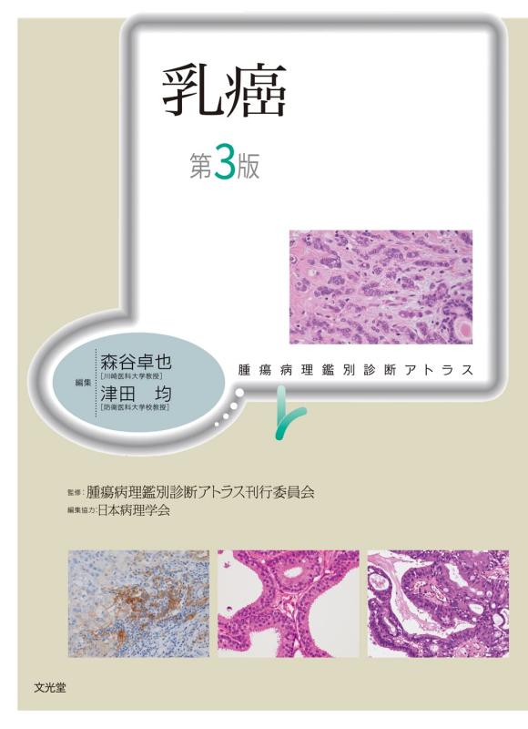 【中古】乳癌　第3版(腫瘍病理鑑別診断アトラス)