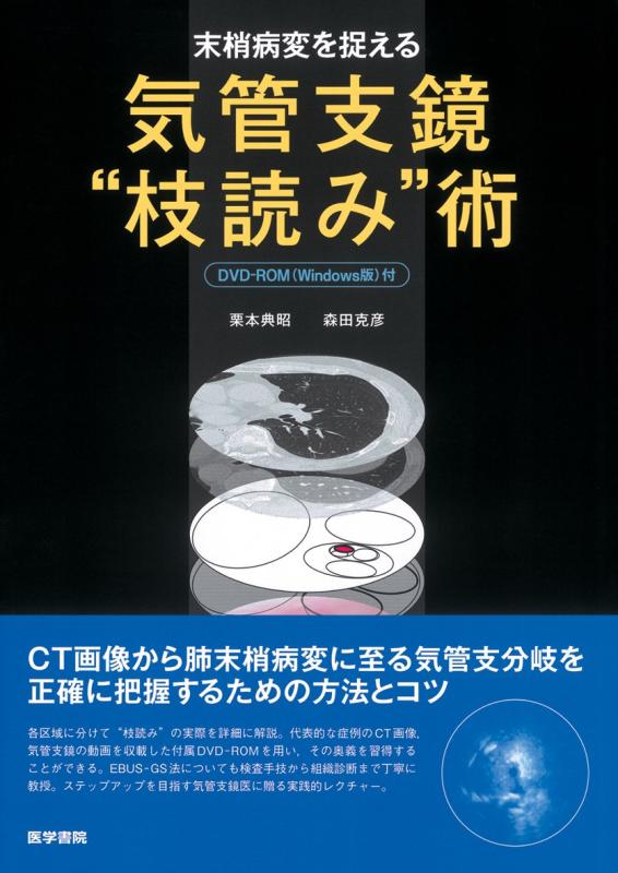 【中古】末梢病変を捉える 気管支鏡“枝読み”術 [DVD-ROM(Windows版)付]