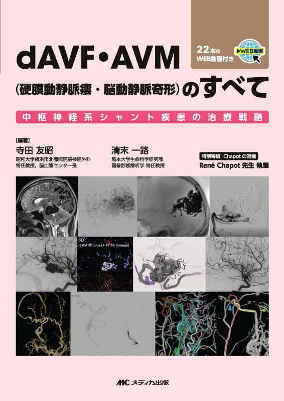 【中古】dAVF・AVM(硬膜動静脈瘻・脳動静脈奇形)のすべて:中枢神経系シャント疾患の治療戦略/22本のWEB動画付き