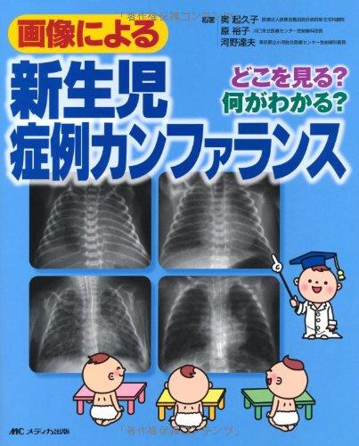 【中古】すがた絵による新生児症例カンファランス: どこを見る? 何がわかる?