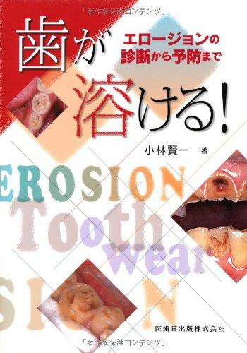 【中古】歯が溶ける エロージョンの診断から予防まで|ソファポテト