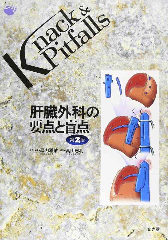 【中古】肝臓外科の要点と盲点 (Knack & pitfalls)