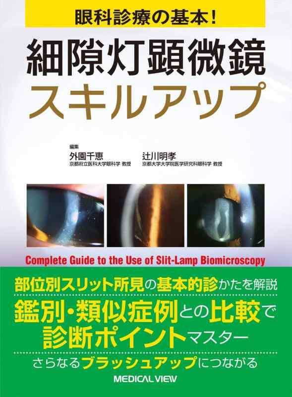 【中古】眼科診療の基本 細隙灯顕微鏡スキルアップ|ソファポテト