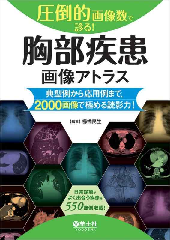 【中古】圧倒的すがた絵数で診る 乳ぶさ病み煩いすがた絵アトラス～基本形例から適用業務例まで、2000すがた絵で極める読影力