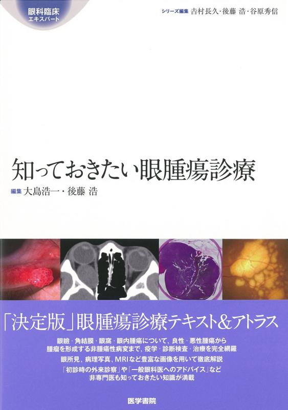 【中古】知っておきたい眼腫瘍診療 (眼科臨床エキスパート) 16,773円