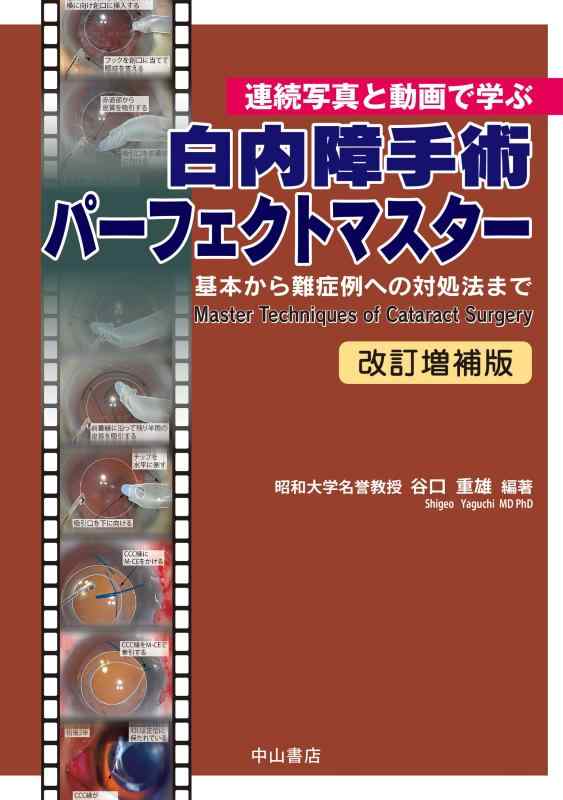 【中古】連続写真と動画で学ぶ 白内障手術パーフェクトマスター　改訂増補版 基本から難症例への対処法まで