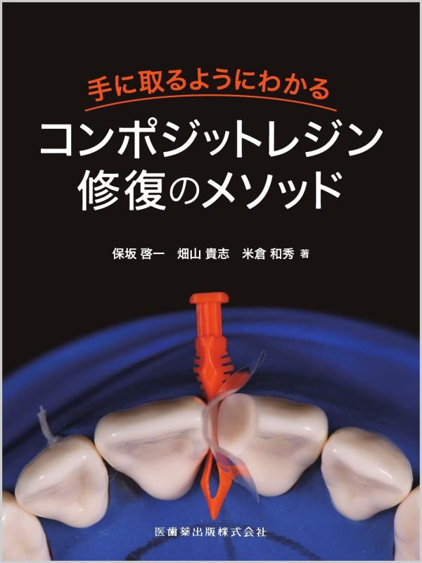 【中古】手に取るようにわかるコンポジットレジン修復のメソッド|ソファポテト