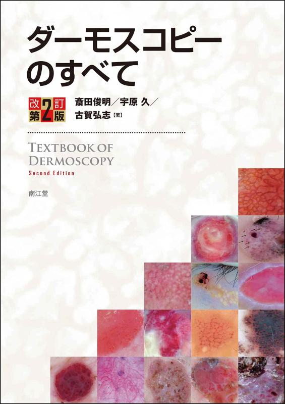 【中古】ダーモスコピーのすべて(改訂第2版)