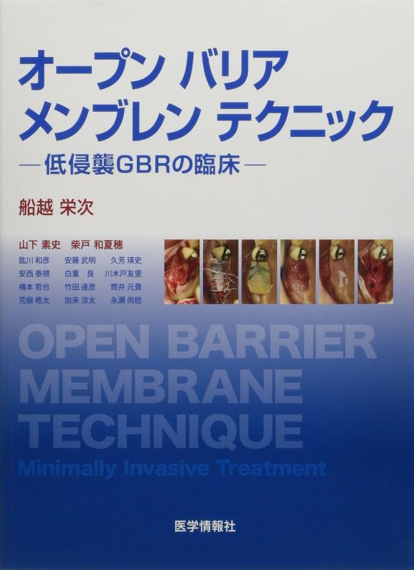 【中古】オープンバリアメンブレンテクニック: 低侵襲GBRの臨床
