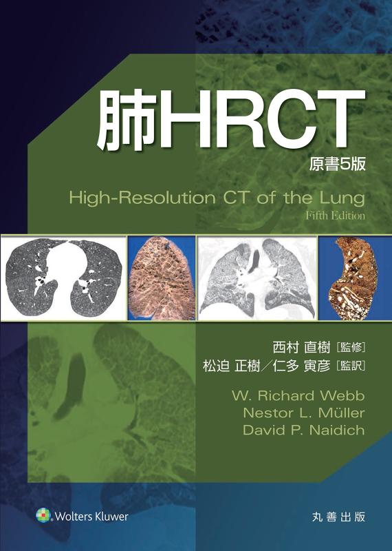 【中古】肺HRCT 原書5版