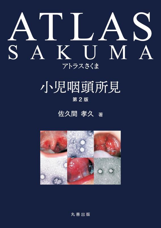 【中古】アトラスさくま 小児咽頭所見 第2版｜ソファポテト