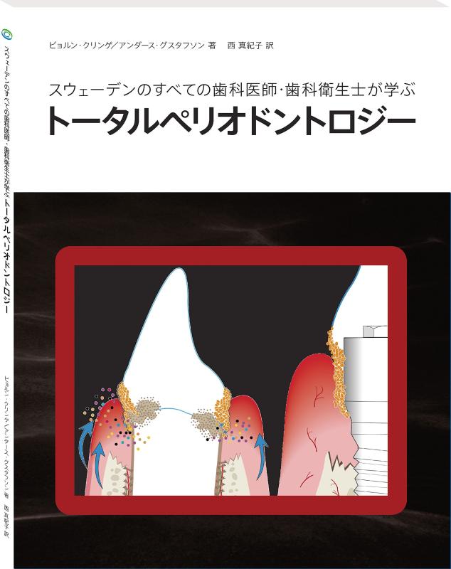 【中古】スウェーデンのすべての歯科医師・歯科衛生士が学ぶトータルペリオドントロジー