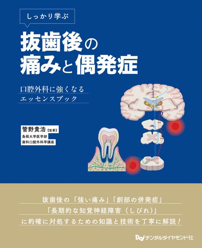 【中古】しっかり学ぶ抜歯後の痛みと偶発症｜ソファポテト