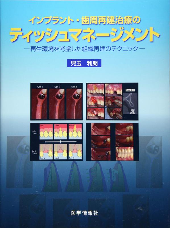 【中古】はたご屋工業プラント・歯周建て替える和らげるのティッシュ管理すること: 生まれ変わり周囲の状況を思いめぐらすした社会システム建て替えるの技法