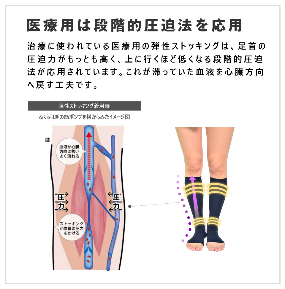 楽天市場 ベノサン フットナース 6000 弾性ストッキング 着圧タイツ むくみ 着圧ソックス 医療用 着圧ストッキング ストッキング 着圧 弾性ストッキング 医療用 下肢静脈瘤 むくみ解消 ソックス タイツ 着圧 足 むくみ 解消 グッズ 弾性ストッキングファクトリー