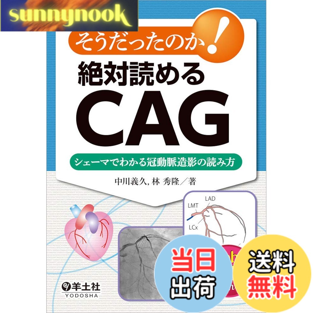【送料無料】そうだったのか! 絶対読めるCAG-シェーマでわかる冠動脈造影の読み方