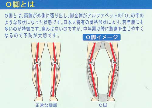 楽天市場 インソールプロ O脚対策 婦人用 Insolepro Sunstone