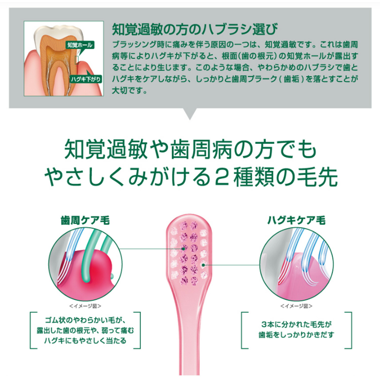 (GUM)ガム・プロケアハイパーセンシティブデンタルブラシ#418(アソートカラー)【代引き不可】【日時指定不可】