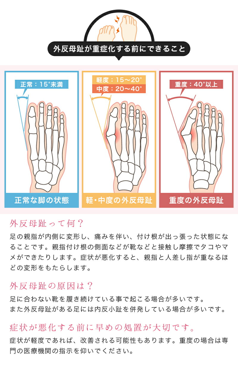 外反母趾 内反小趾 サポーター 親指 足指 シリコンパッド シリコン 両足セット セパレーター パッド 指間 クッション 広げる 軽減 歩行 Meru1 足指用 つま先 ストレッチ 予防 サポート 公式ストア 保護 巻き爪 フットケア 衝撃吸収 痛み