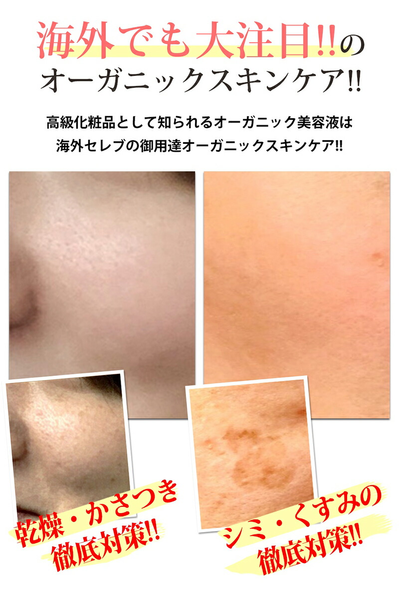 楽天市場 美容液 トライアル 3ml 5個オルナ オーガニックくすみ 対策 用 コラーゲン 3種 ヒアルロン酸 4種 ビタミンc 4種 セラミド 配合 しっかり 保湿 を実現させる 美容 成分の黄金比を確立allna Organic 鶴西オンラインショップ