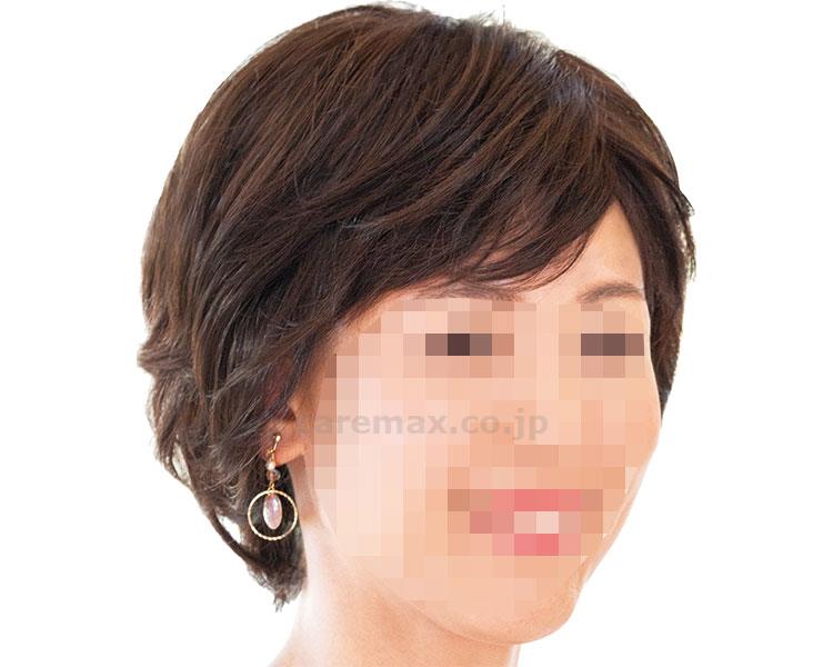 ★9/4-11 P最大27倍★【全国配送可】-医療用ウィッグ　フィットミー MW-603　♯2_明栗色 　JAN 4515754018905 kt493784 取寄品 医療・施設 その他医療 その他(その他医療)-【介護福祉用具】 26,141円