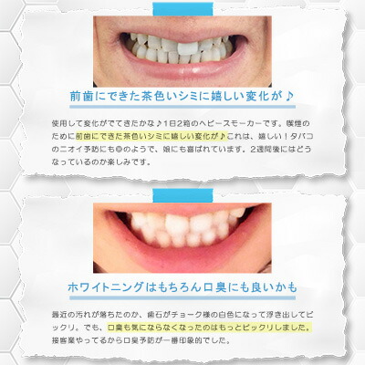 楽天市場 楽天最安値挑戦 注文殺到中 大容量 歯のホワイトニング革命 手ぶらok ホワイトショック Ledマウスピース セット ペースト92g付 ホームホワイトニング ホワイトニング 歯 セルフ 自宅 Led Ledライト マウスピース 歯磨き粉 送料無料 Blanx Whiteshock