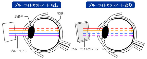 ☆決算特価商品☆ シャープ 電子辞書 ブレーン 保護 フィルム OverLay Eye Protector for SHARP カラー電子辞書  Brain 2021年モデル PW-B1 S1 H1 J1 A1 ミヤビックス www.agroservet.com