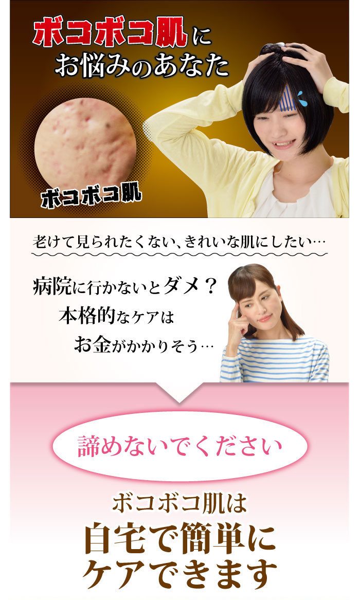 楽天市場 ピーリング ゴマージュ 角質 代謝 ボコボコ肌 角質除去 顔 角質ケア ピーリングミルク 角質 角質除去 角質ケア 顔 ポロポロ 角質落とし ヴィヴィアン ネオ