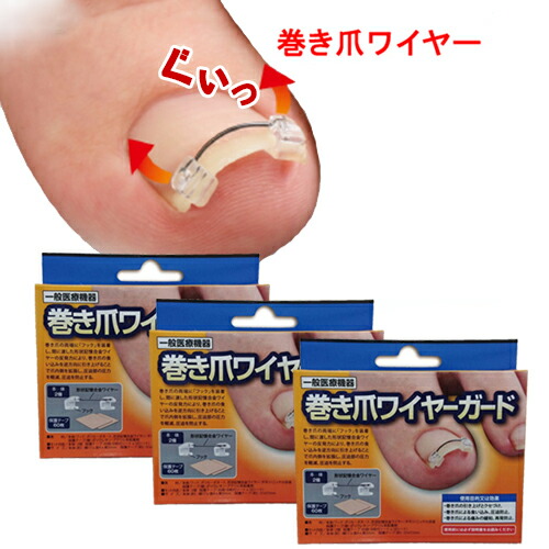 100 本物保証 楽天市場 すぐ使える500円offクーポン対象 巻き爪 クリップ 巻きづめ ワイヤー 巻き爪 ワイヤー 巻き爪 セルフケア 一般医療機器 巻き爪ワイヤーガード 3個セット 美活応援店 アットシュシュ 限定製作 Www Mauxiliadoralugo Com