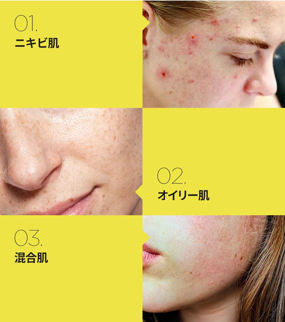 楽天市場 バイウィッシュトレンド サルファー3 クリーンジェル 30g 韓国コスメ ニキビ トラブル スポットケア 皮脂ケア 抗菌 抗炎症 By Wishtrend Sulfur 3 Clean Gel 30g Wishtrend