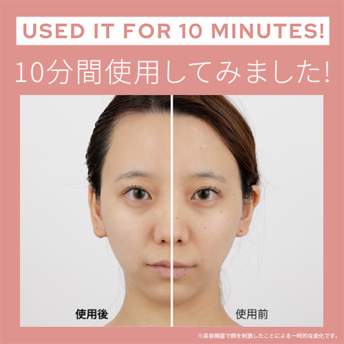 美顔器 ブラシ 頭皮 【ヤーマン公式】《ミーゼ スカルプリフト