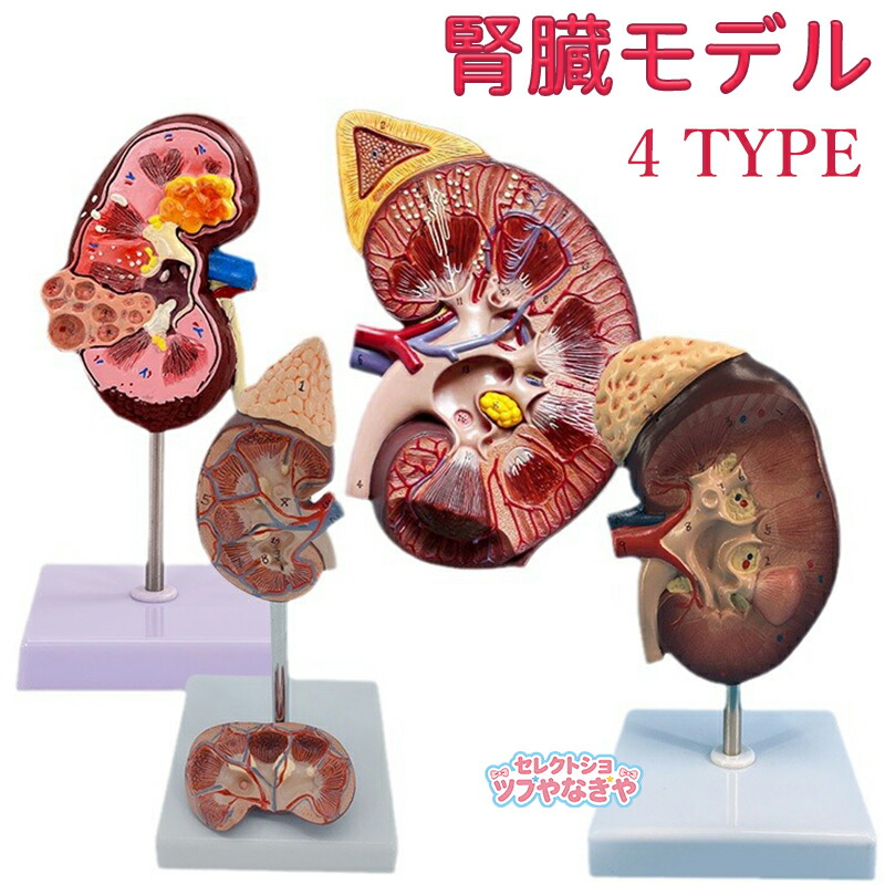 腎臓モデル マネキン 腎臓解剖モデル 解剖学臓器モデル 人間の臓器モデル 解剖学的モデル 生物学デモンストレーション