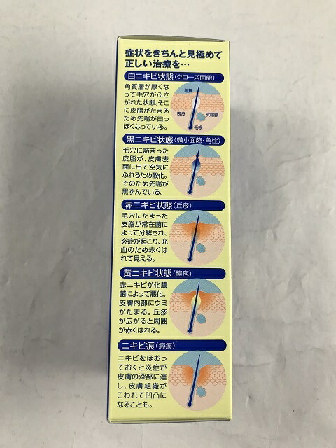 楽天市場 2個セット 第2類医薬品 メンターム アクネローション 110ml ニキビ が気になる方に ケンコウlife