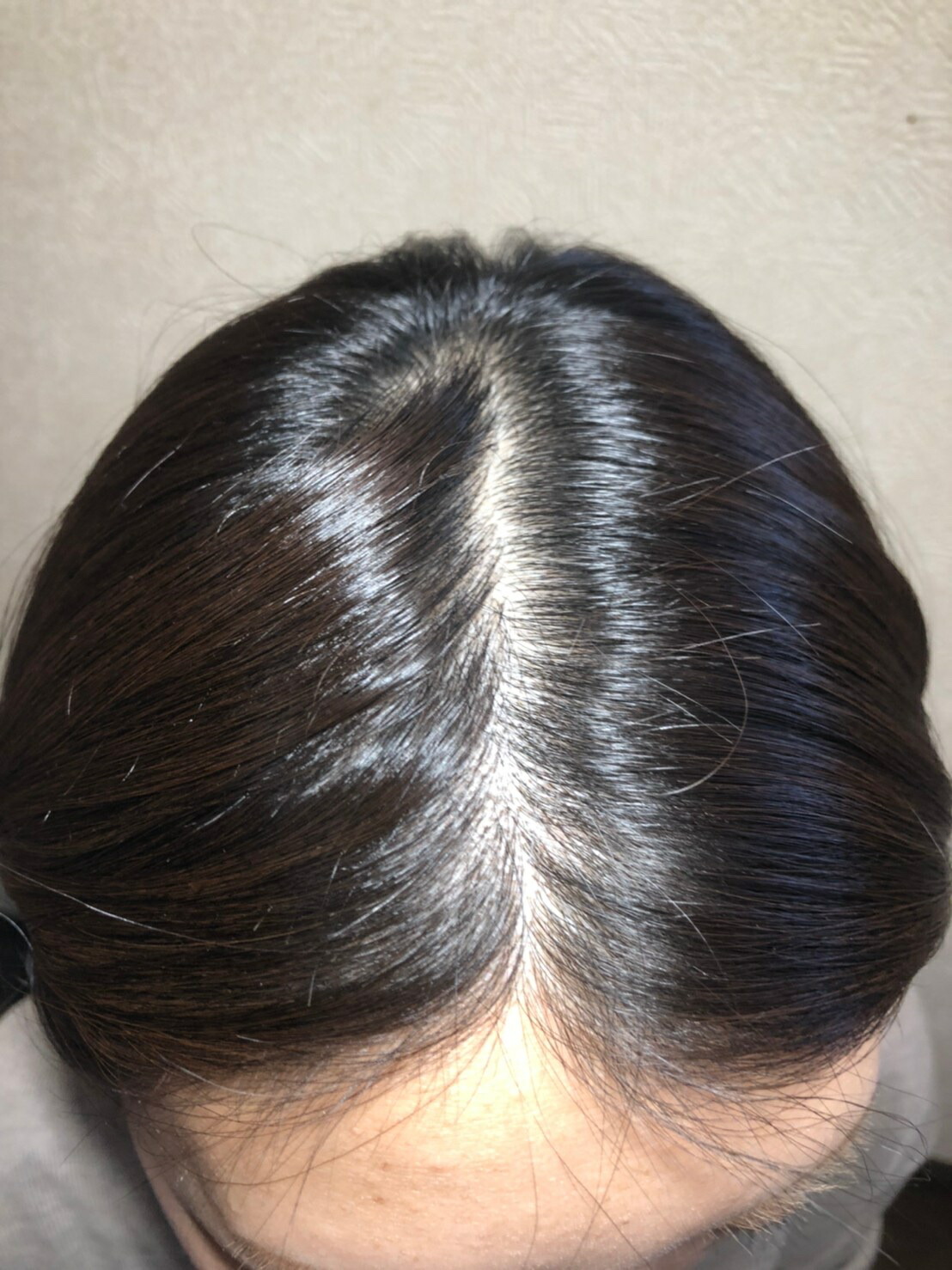 前髪付き 総手植え 人毛 長さ約25cm クリップ式 ヘアピース ブラック ブラウン 医療用ウィッグ 脱毛 薄毛 白髪 抜け毛 円形脱毛 ボリュームアップ ウイッグ Msselectronics Gr