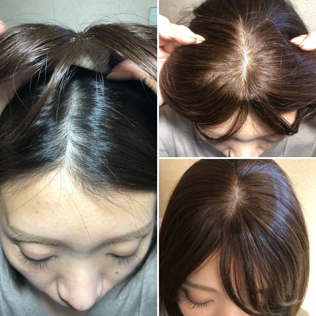 前髪付き 総手植え 人毛 長さ約25cm クリップ式 ヘアピース ブラック ブラウン 医療用ウィッグ 脱毛 薄毛 白髪 抜け毛 円形脱毛 ボリュームアップ ウイッグ Msselectronics Gr