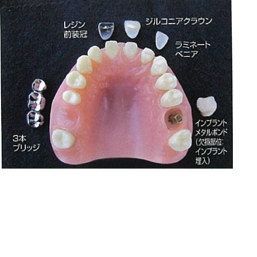 リアルモデルB 1個 27,885円